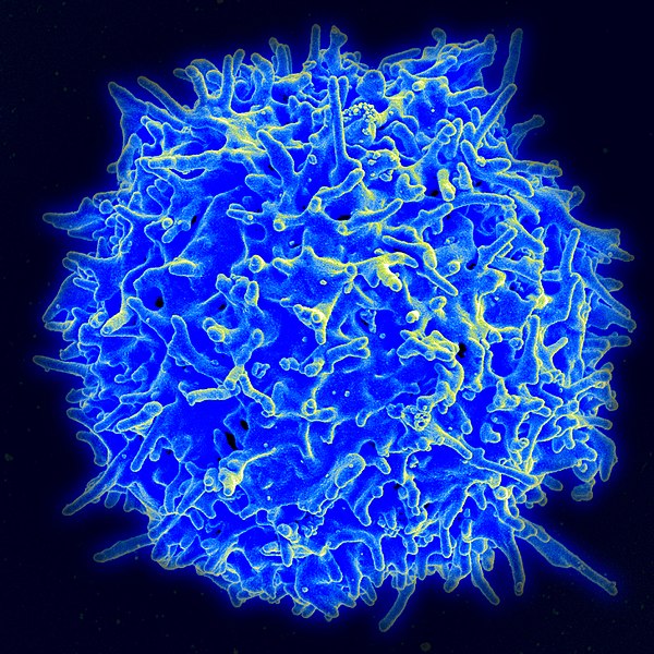 Scanning electron micrograph of a human T lymphocyte (also called a T cell) from the immune system of a healthy donor. Credit: NIAID