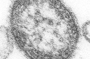 Measles virus. Photo: CynthiaGoldsmith/CDC