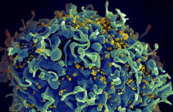 A human T cell, in blue, under attack by HIV, in yellow. NIH