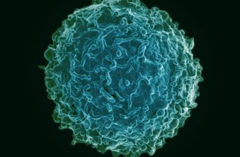 Micrograph of a human B lymphocyte, an antibody-preducing white cell