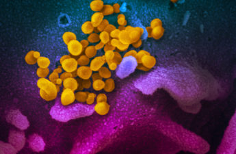 Novel Coronavirus SARS-CoV-2 This scanning electron microscope image shows SARS-CoV-2 (yellow)—also known as 2019-nCoV, the virus that causes COVID-19—isolated from a patient in the U.S., emerging from the surface of cells (blue/pink) cultured in the lab. Credit: NIAID-RML