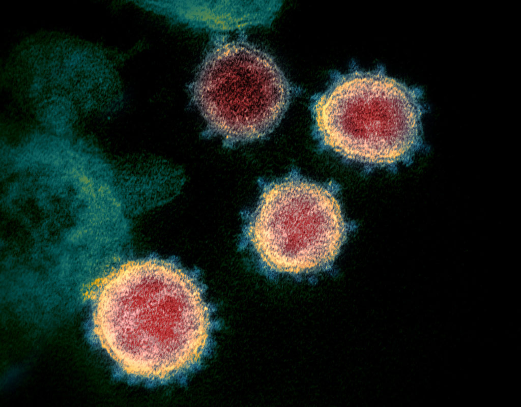 Four coronavirus particles.