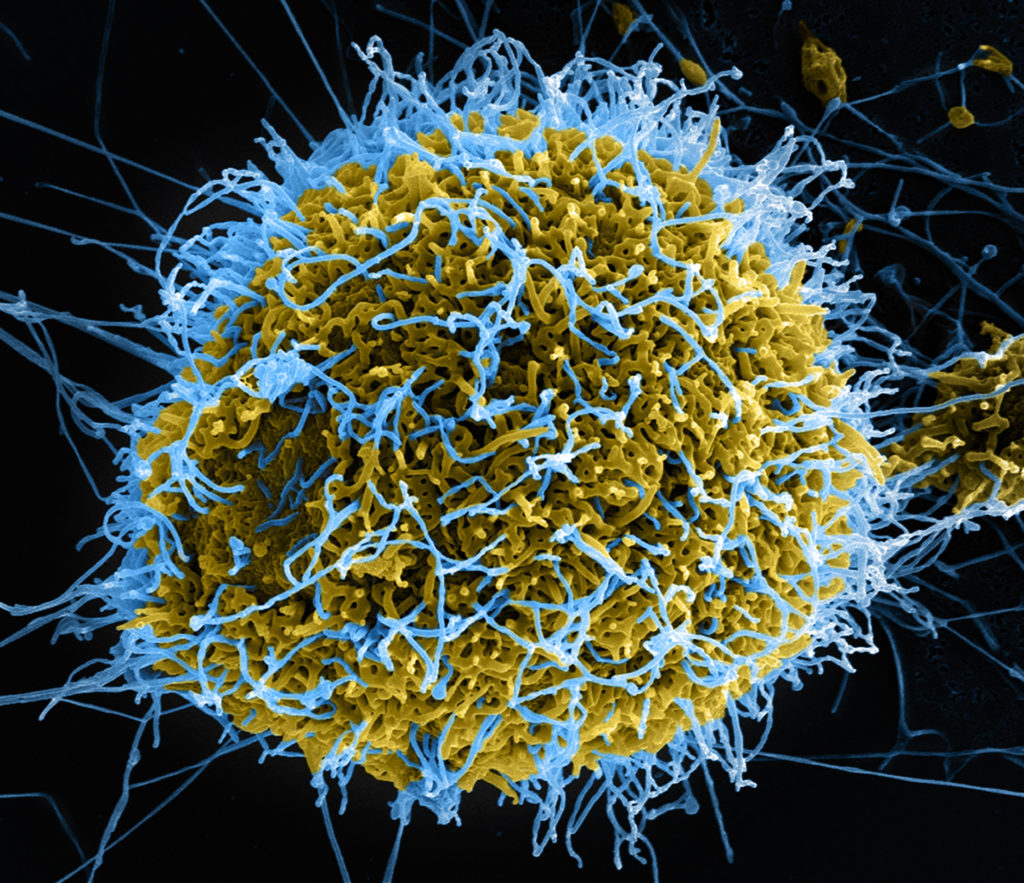 Ebola Virus Particles 
Colorized scanning electron micrograph of filamentous Ebola virus particles (blue) budding from a chronically infected VERO E6 cell (yellow-green). Image captured and color-enhanced at the NIAID Integrated Research Facility in Ft. Detrick, Maryland. Credit: NIAID