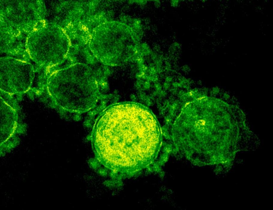 digitally colorized transmission electron microscopic (TEM) image reveals ultrastructural details exhibited by a number of spherical shaped, Middle East respiratory syndrome coronavirus (MERS-CoV) virions.