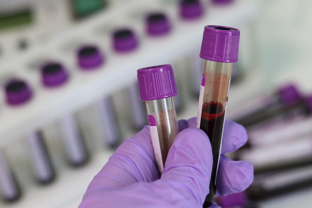 Purple capped test tubes containing blood samples in a lab