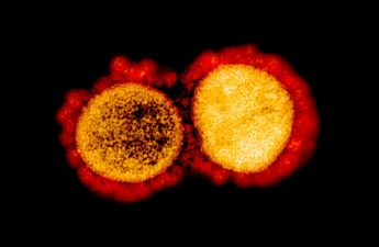 Electron micrograph of SARS-CoV-2, the coronavirus responsible for COVID-19