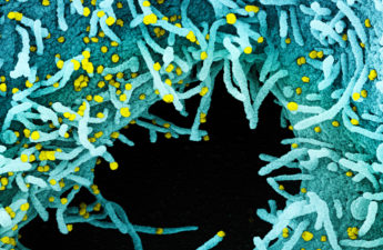 Colorized scanning electron micrograph of a cell heavily infected with SARS-CoV-2 virus particles (yellow), isolated from a patient sample. The black area in the image is extracellular space between the cells. Image captured at the NIAID Integrated Research Facility (IRF) in Fort Detrick, Maryland. Credit: NIAID