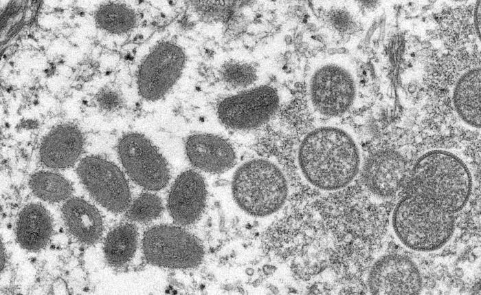 This electron microscopic (EM) image depicted a monkeypox virion, obtained from a clinical sample associated with the 2003 prairie dog outbreak. It was a thin section image from of a human skin sample. On the left were mature, oval-shaped virus particles, and on the right were the crescents, and spherical particles of immature virions.