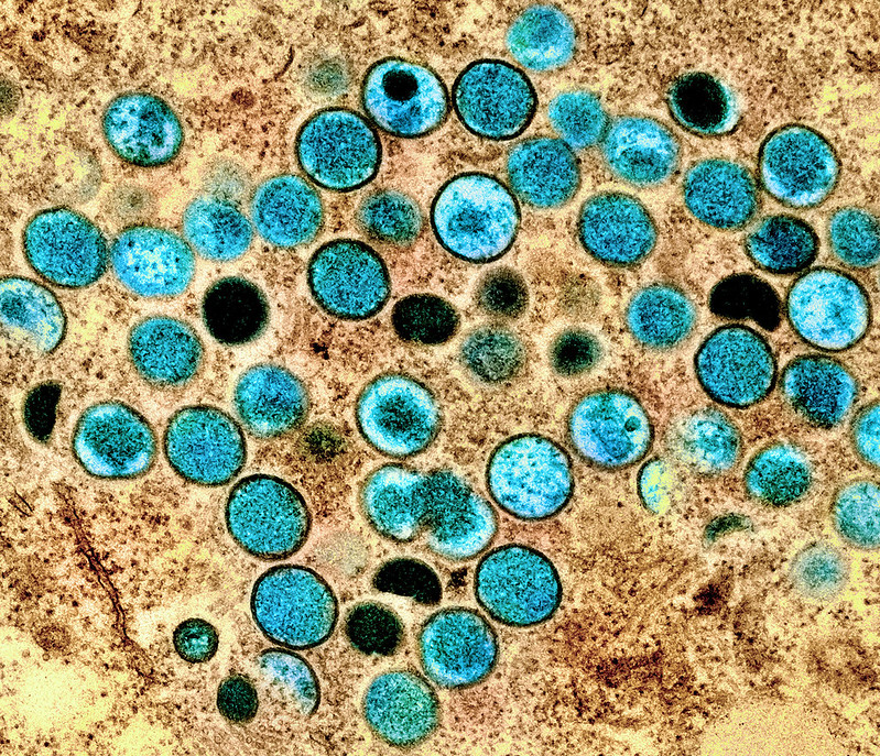 Colorized transmission electron micrograph of monkeypox virus particles (teal) cultivated and purified from cell culture. Image captured at the NIAID Integrated Research Facility (IRF) in Fort Detrick, Maryland. Credit: NIAID
