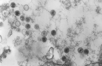 Electron microscopic image of Epstein-Barr Virus (EBV) , the virus that causes mononucleosis.