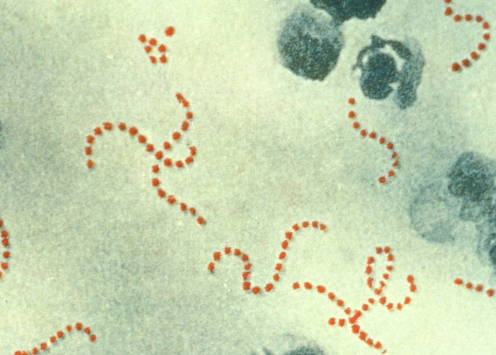 Photomicrograph of Streptococcus pyogenes bacteria, magnified 900 fold. Photo: US Centers for Disease Control and Prevention.