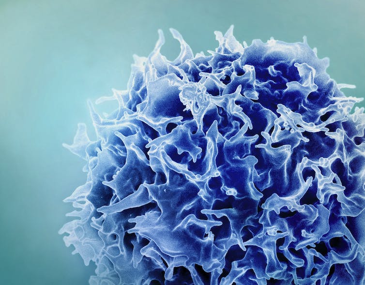 Immune cell. Photo: NIAID/Flickr, CC BY-SA