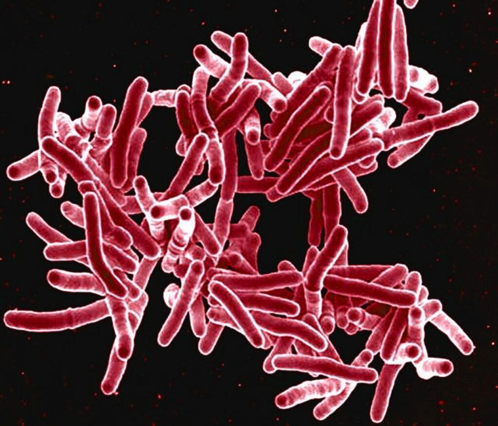  A digitally colorized scan of Mycobacterium tuberculosis bacteria, which cause tuberculosis in human beings. Although tuberculosis cases have been rising, public health departments say they lack the resources to stop the disease from spreading. Courtesy of the National Institute of Allergy and Infectious Diseases
