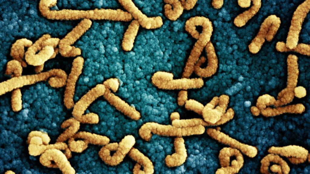 A colorized scanning electron micrograph of Marburg virus particles.NIAID
