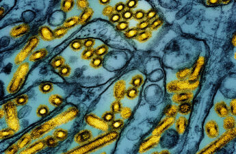 Colorized transmission electron micrograph of avian influenza A H5N1 virus particles (yellow). Microscopy by CDC; repositioned and recolored by NIAID. Credit: CDC and NIAID.